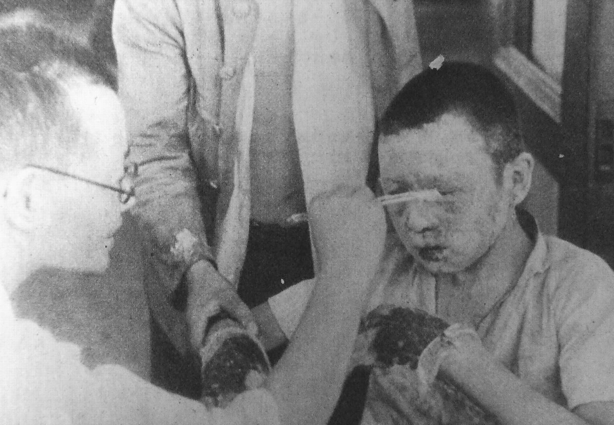 Мальчика лечат от ожогов лица и рук в больнице Красного Креста. 10 августа 1945 г.