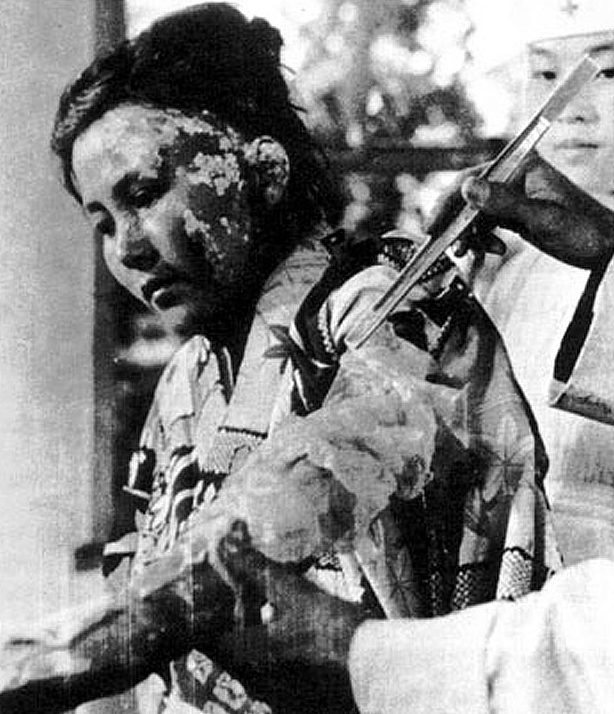 22-летняя жертва бомбардировки проходит лечение в больнице. 6 октября, 1945 г.