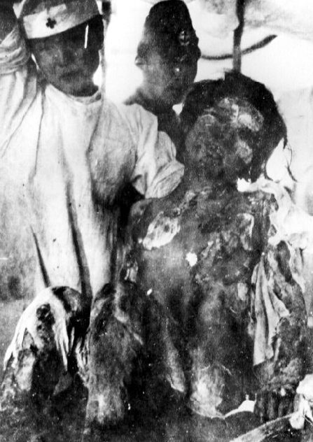 Жертвы бомбардировки. Август 1945 г.