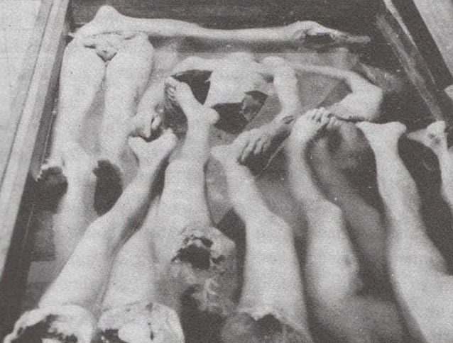 «Отходы производства» в медицинском центре лагеря, где экспериментировали с пересадкой конечностей женщин.
