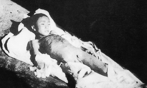 Тело мальчика лет семи, который умер через три дня после поступления в университетскую больницу. Он получил пять штыковых ранений в живот. Декабрь 1937 г. 