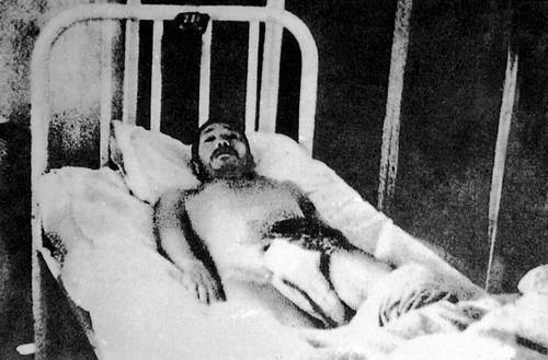 Китаец в больнице, которому японцы прожгли живот. Декабрь 1937 г.