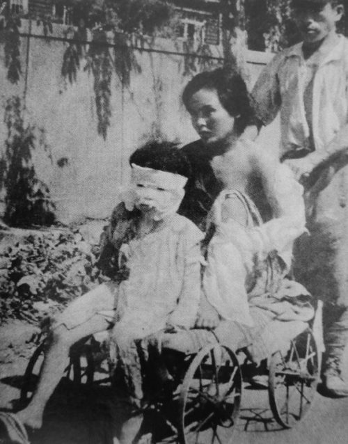 Пострадавшие дети Хиросимы от атомной бомбардировки. Август 1945 г.