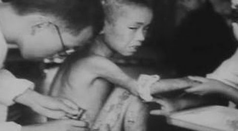 Раненные дети в Нагасаки после атомной бомбардировки. Август 1945 г.