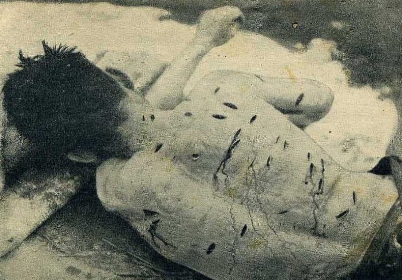 На теле крестьянина Ивахова Б., замученного поляками на Радеховщине, обнаружено 52 раны нанесенных штык-ножом. Октябрь 1943 г.