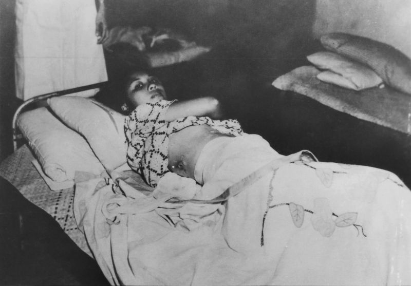 Раненные японскими солдатами филиппинские мирные жители в госпитале в Маниле. Март 1945 г. 
