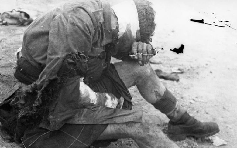 Раненный коммандос, попавший в плен к немцам во время рейда на Сен-Назер. 28 марта 1942 г. 
