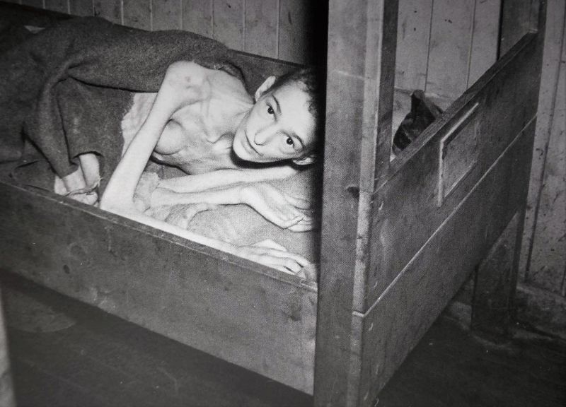 Освобожденная узница концлагеря Берген-Бельзен, заболевшая тифом. Апрель 1945 г. 