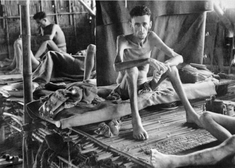 Истощенные британские военнопленные в японском госпитале в Наком-Патоне, Таиланд. 1945 год.