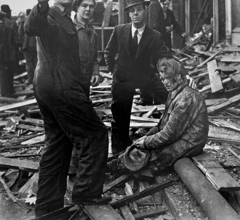 Житель Лондона, раненный при попадании немецкой ракеты «Фау-2» в рынок Смитфилд. Февраль 1945 г. 